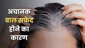 अचानक बाल सफेद होने का क्या कारण है? एक्सपर्ट से जानें